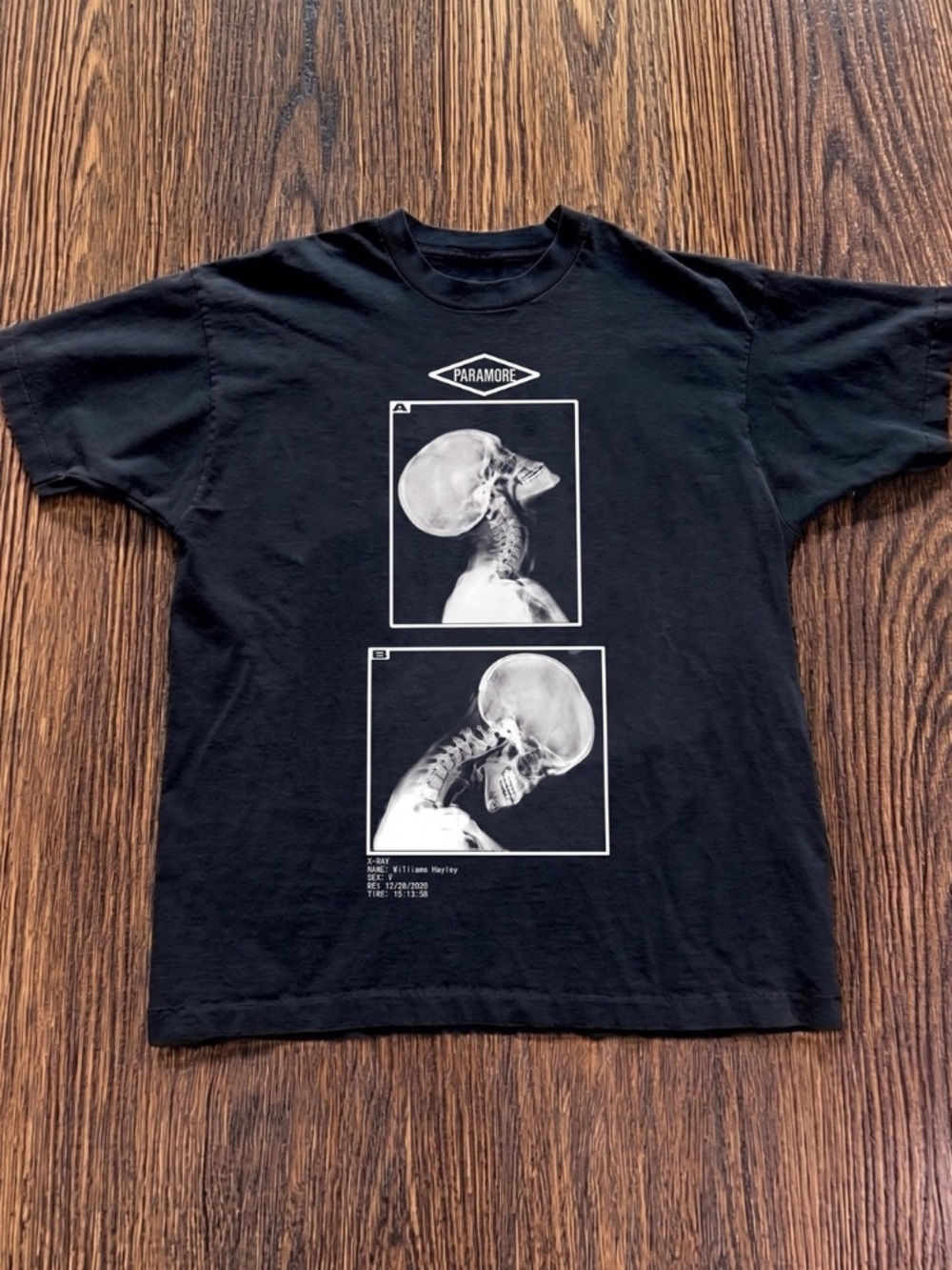 Black Tee with White Skull X-Ray Graphic